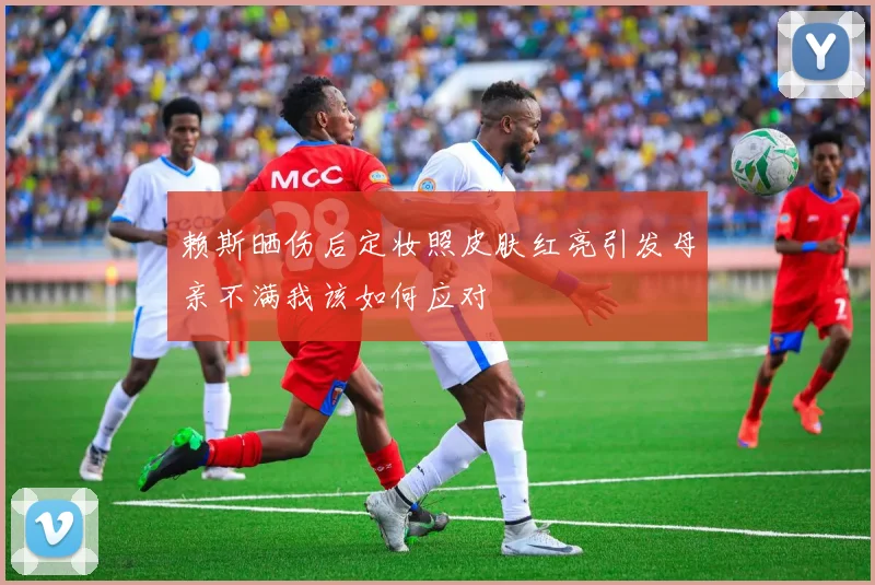 赖斯晒伤后定妆照皮肤红亮引发母亲不满我该如何应对